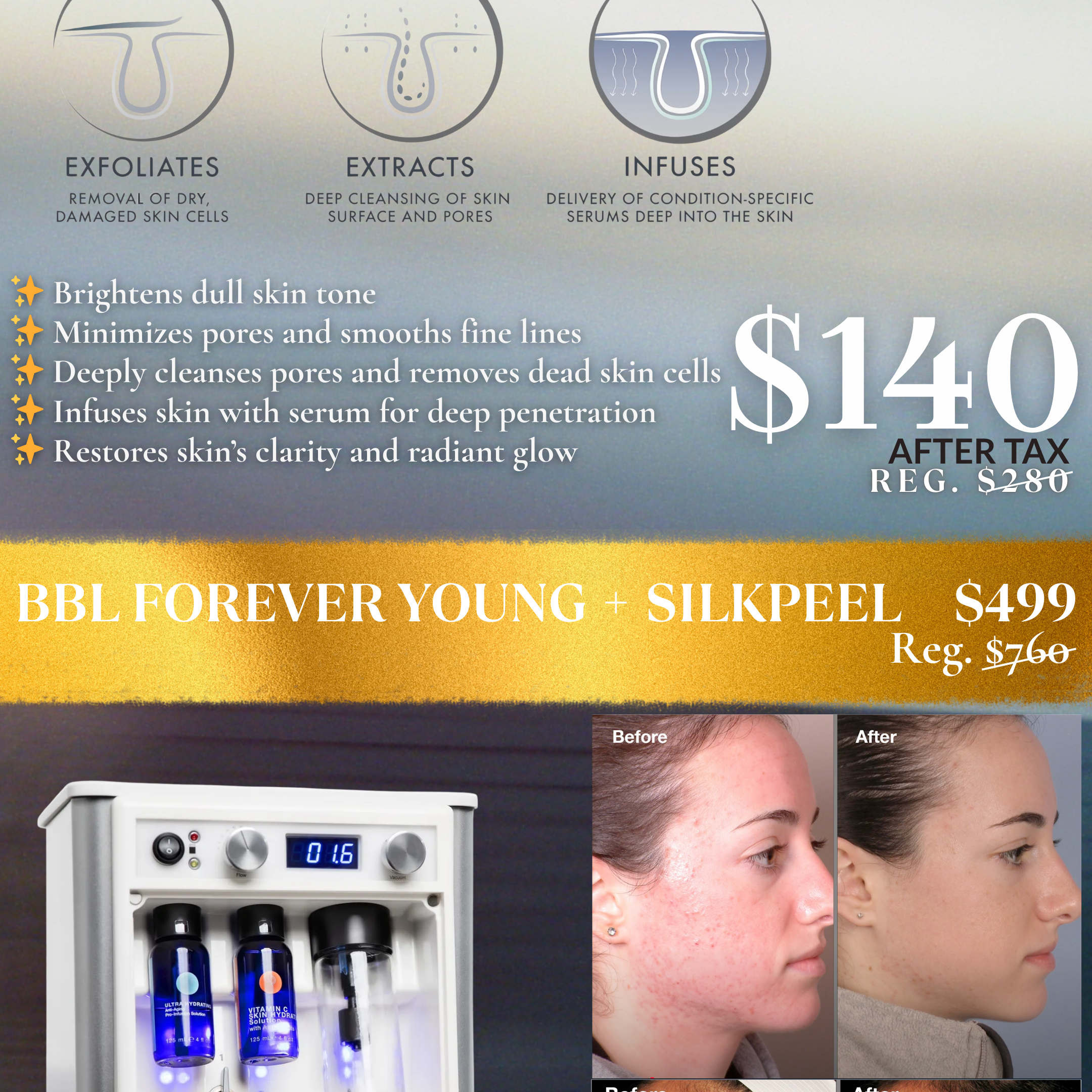 Clarion Silkpeel