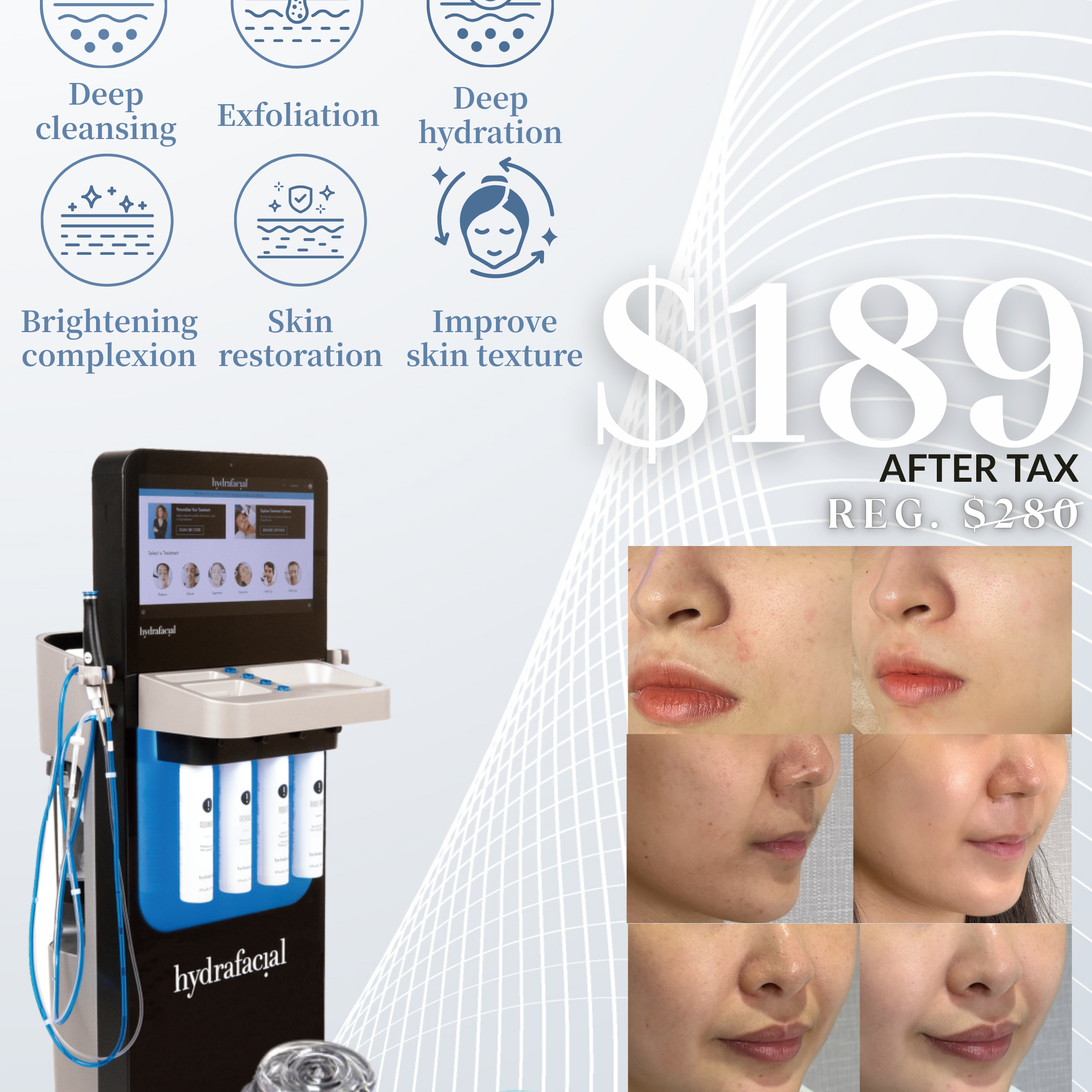 Hydrafacial 海菲秀